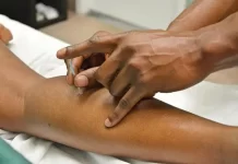 Utilizing Acupuncture to Address Anxiety and Depression