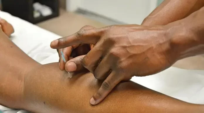 Utilizing Acupuncture to Address Anxiety and Depression